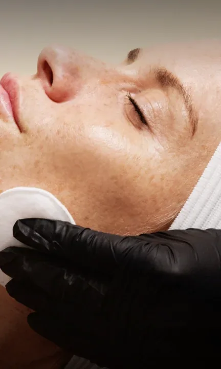 Skin Laundry short-form post: a close view of a woman lying back with closed eyes as a gloved hand holds a cotton pad to her face.