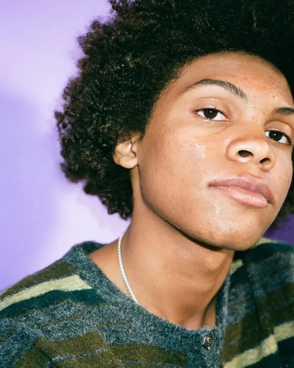 Starface short-form post: a young man in a patterned sweater looking at the camera with small clear patches on his cheek against a lilac wall.